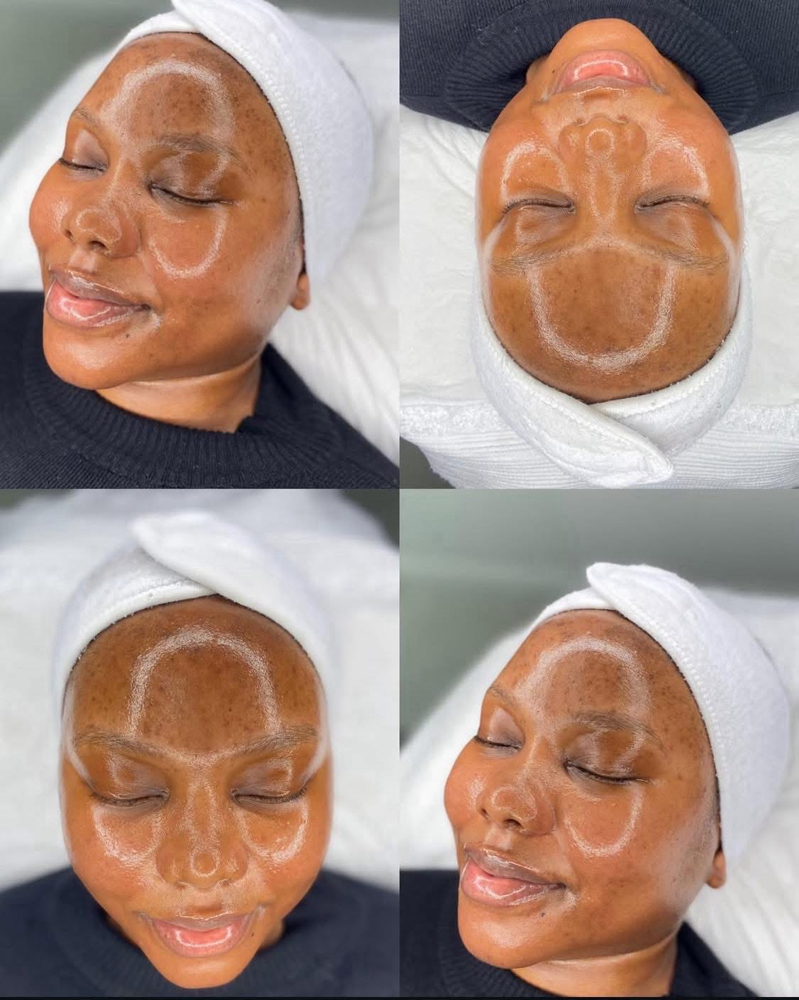 Porcelean Facial