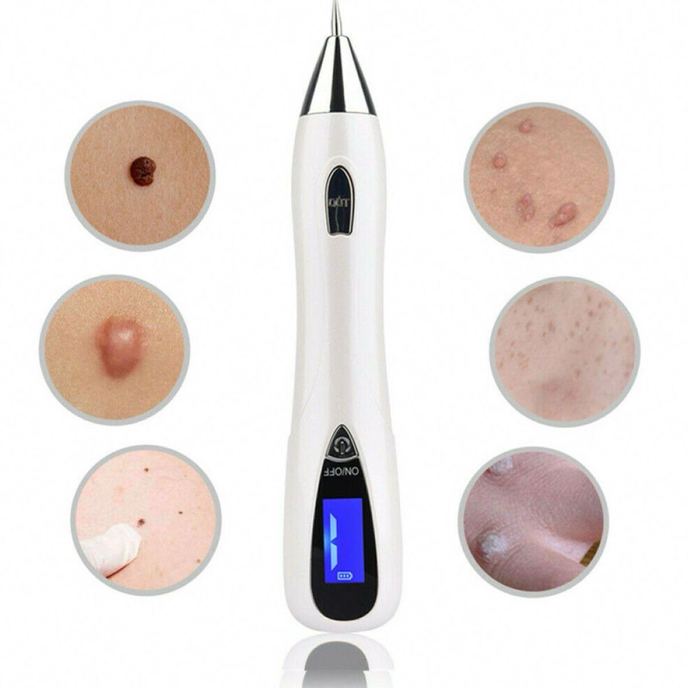 Skin Tag and Mole Removal at Bare Esthetics Medical Spa LLC in Idabel, OK