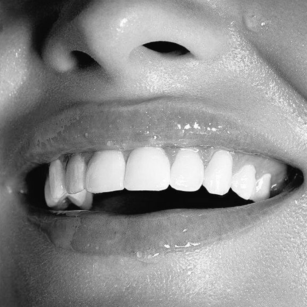 Teeth Whitening at Vitality Skin in Westby, WI