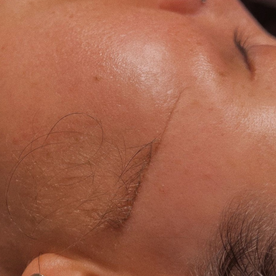 Dermaplane | Add-On at The Coastal Cove Salon & Spa in Spring, TX