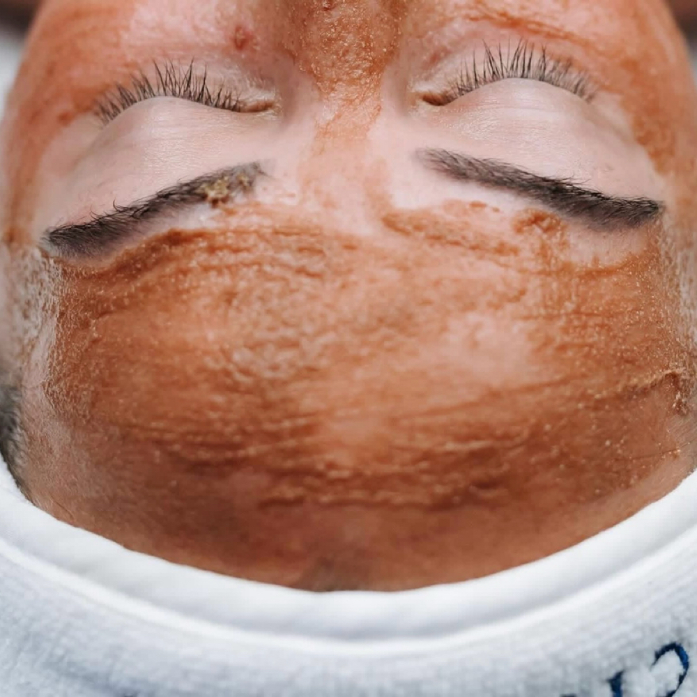 Enzyme Renewal Facial at Mla.Aesthetics in Grants Pass, OR