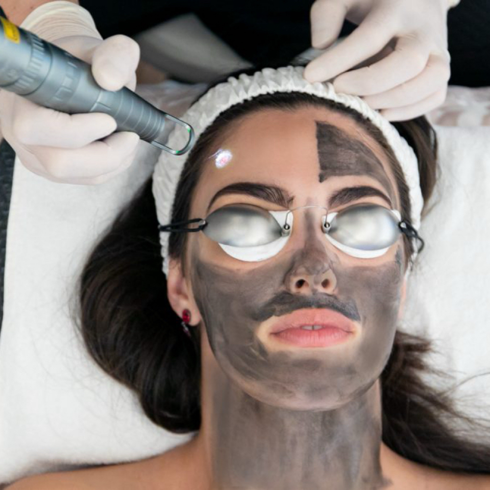 Hollywood Peel Laser at Lumière Aesthetics in Grand Prairie, TX