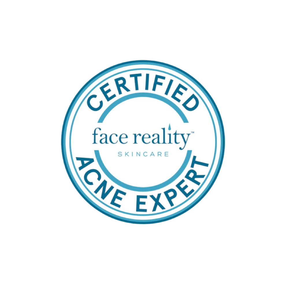 Acne Bootcamp: Consult + Treatment at Lillian Marie Aesthetics in Burlington, WI