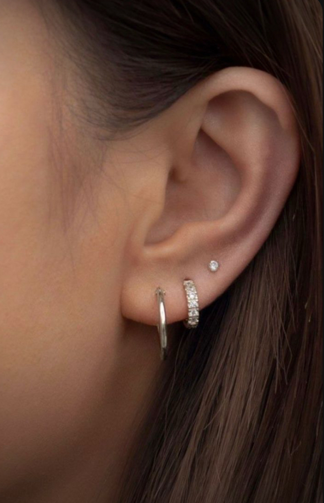 Lobes