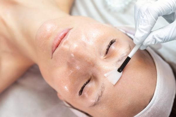 No Peel All Glow - Chemical Peel at OhMyGlow Beauty Esthetics in Fort Lupton, CO
