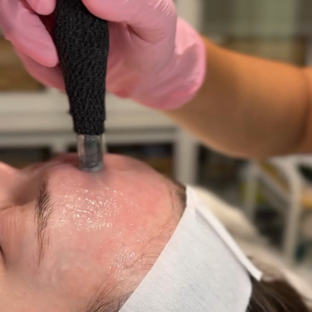 NANO INFUSION FACIAL at Czerinaesthetics, LLC in San Antonio, TX