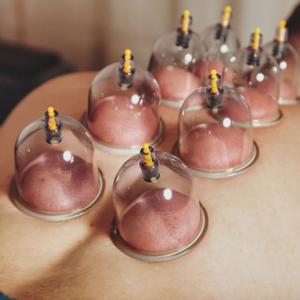 Cupping Therapy- ADD ON at APEX MASSAGE & BODYWORK in San Angelo, TX