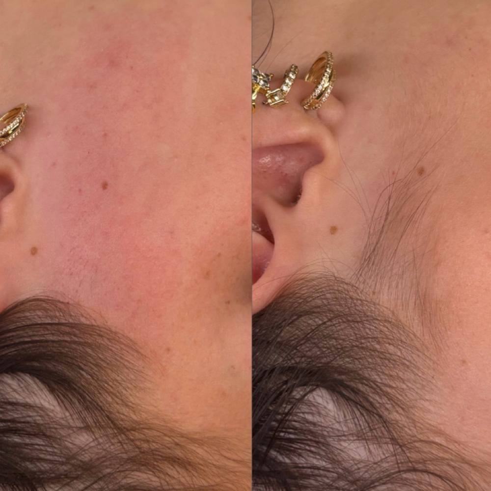 Sides Of Face Wax at planet HER in Alexandria, IN