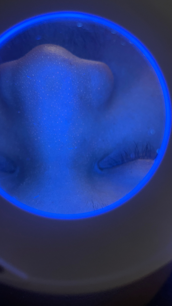 Skin Consultation