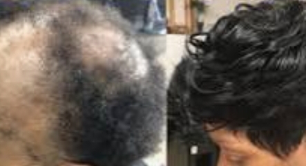 Pixie Install (THIN HAIR ONLY)