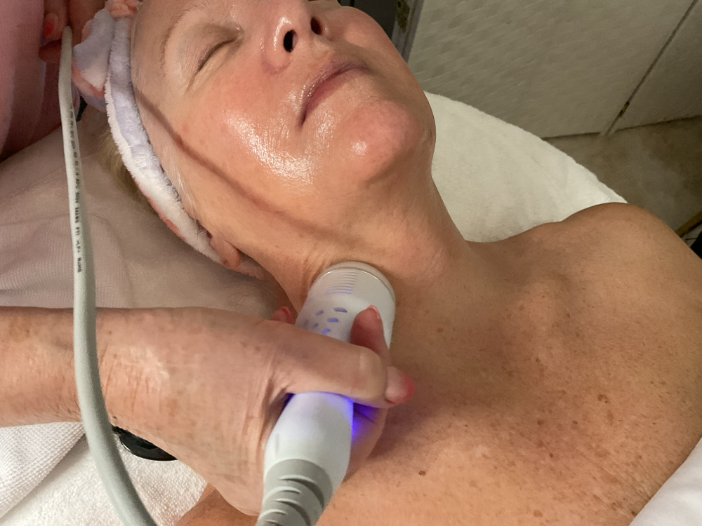 Cryo Ultrasound Facial