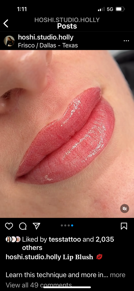 Cosmetic Lip Blush