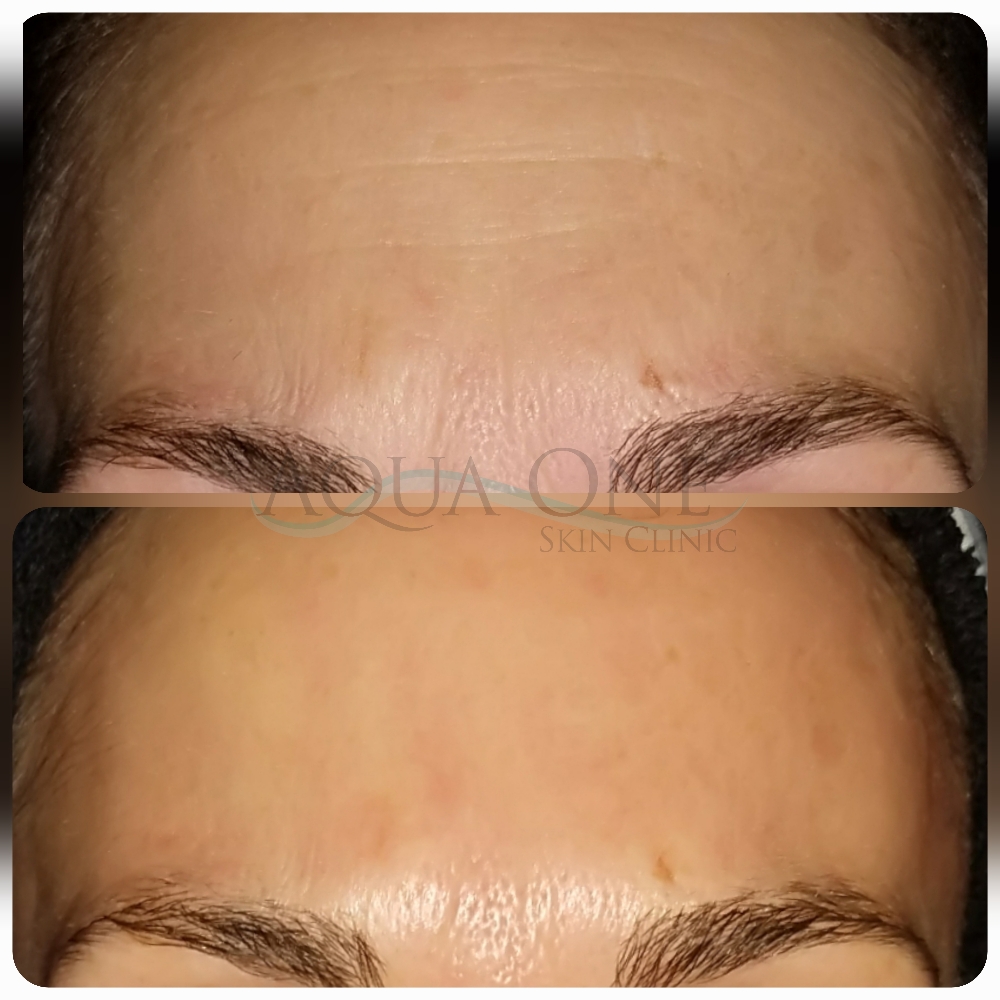 Add-On BEST. FACIAL. EVER.
