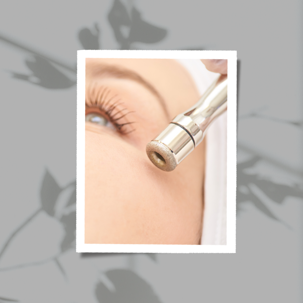 Microdermabrasion Facial