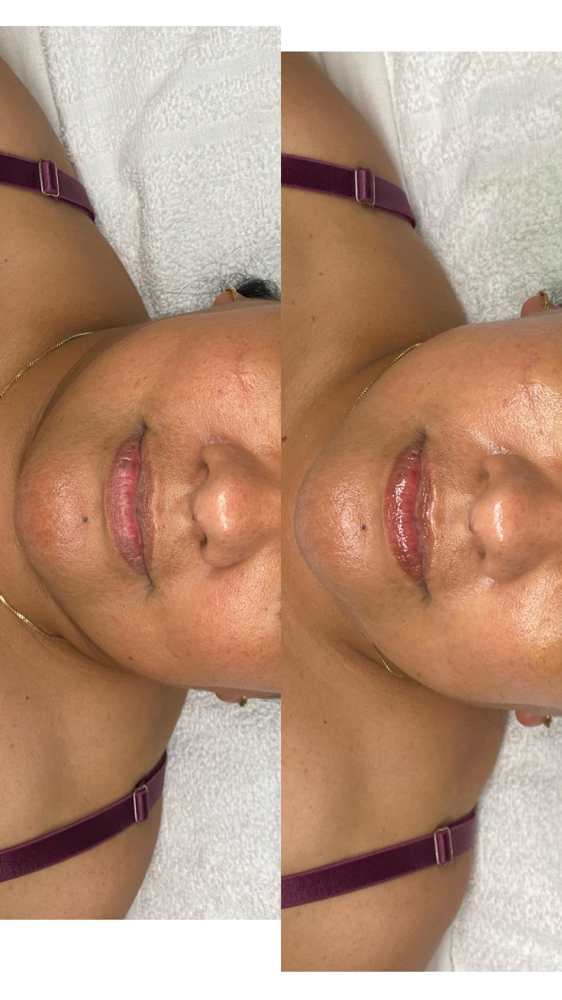 Age In Grace Facial