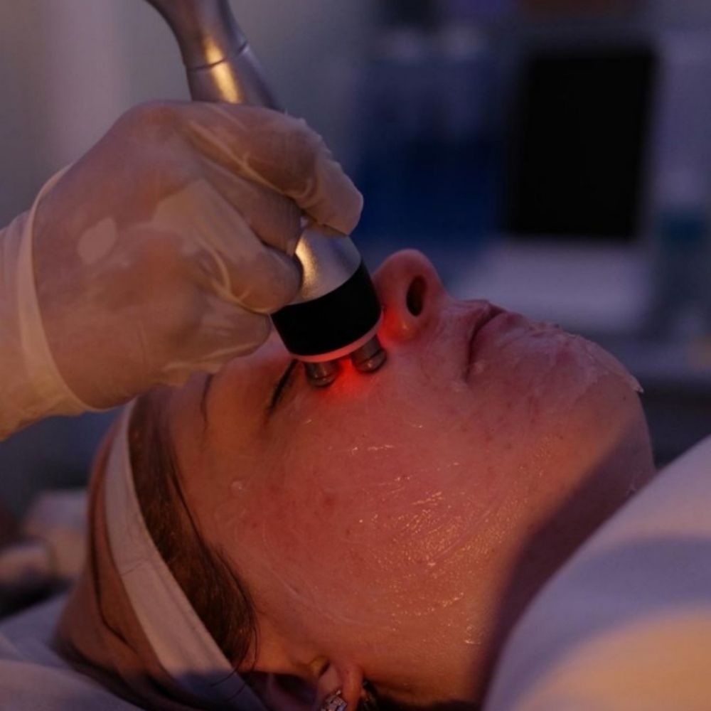 Non-invasive Face Lift at Salon Bliss.LLC in Highland, IN