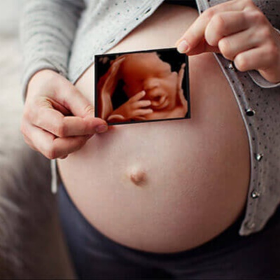 HD Live Ultrasound 5D at Rancho Cucamonga 3D 4D Ultrasound by 4D Special Delivery in Rancho Cucamonga, CA