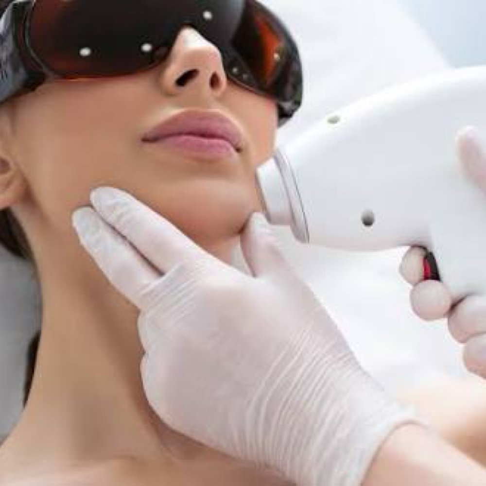Laser Hair Removal- Chin at Chatuge Med Spa & Fitness in Hiawassee, GA