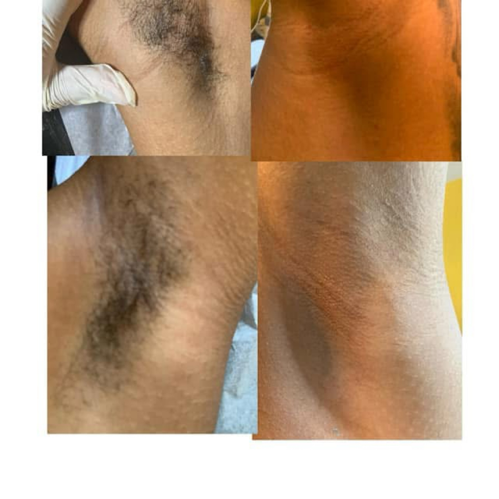 Underarm Waxing at Your Local Coochie Waxer in Louisville, KY