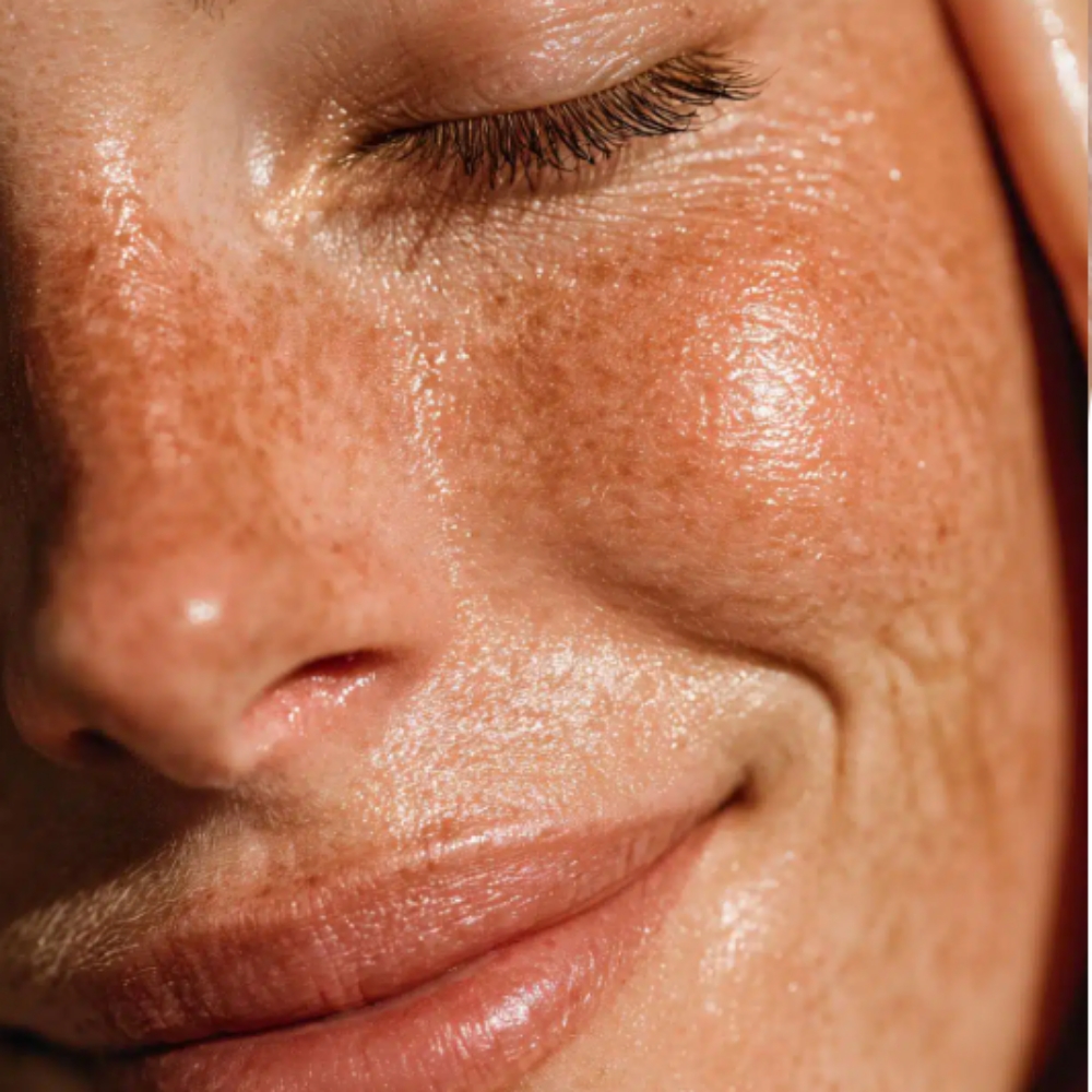 Sola Recovery Facial - June Promo at Esthetics With Candise in Omaha, NE