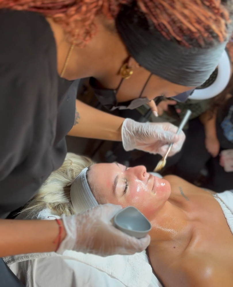 Chemical Peel