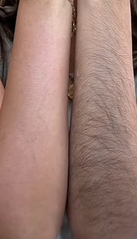 Arms Half