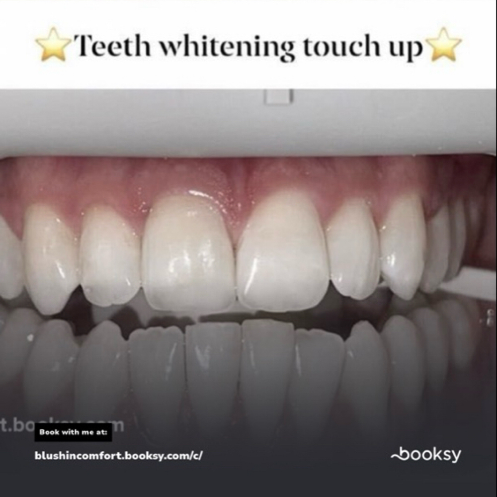 Blush In Comfort Teeth whitening at Blush in Comfort in Wilbraham, MA