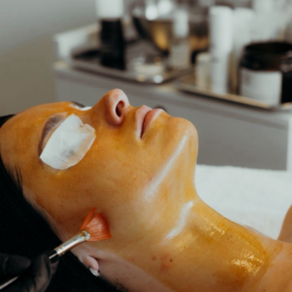 Acne Reset Series ✨ at Everlasting Aesthetics LLC in Surprise, AZ