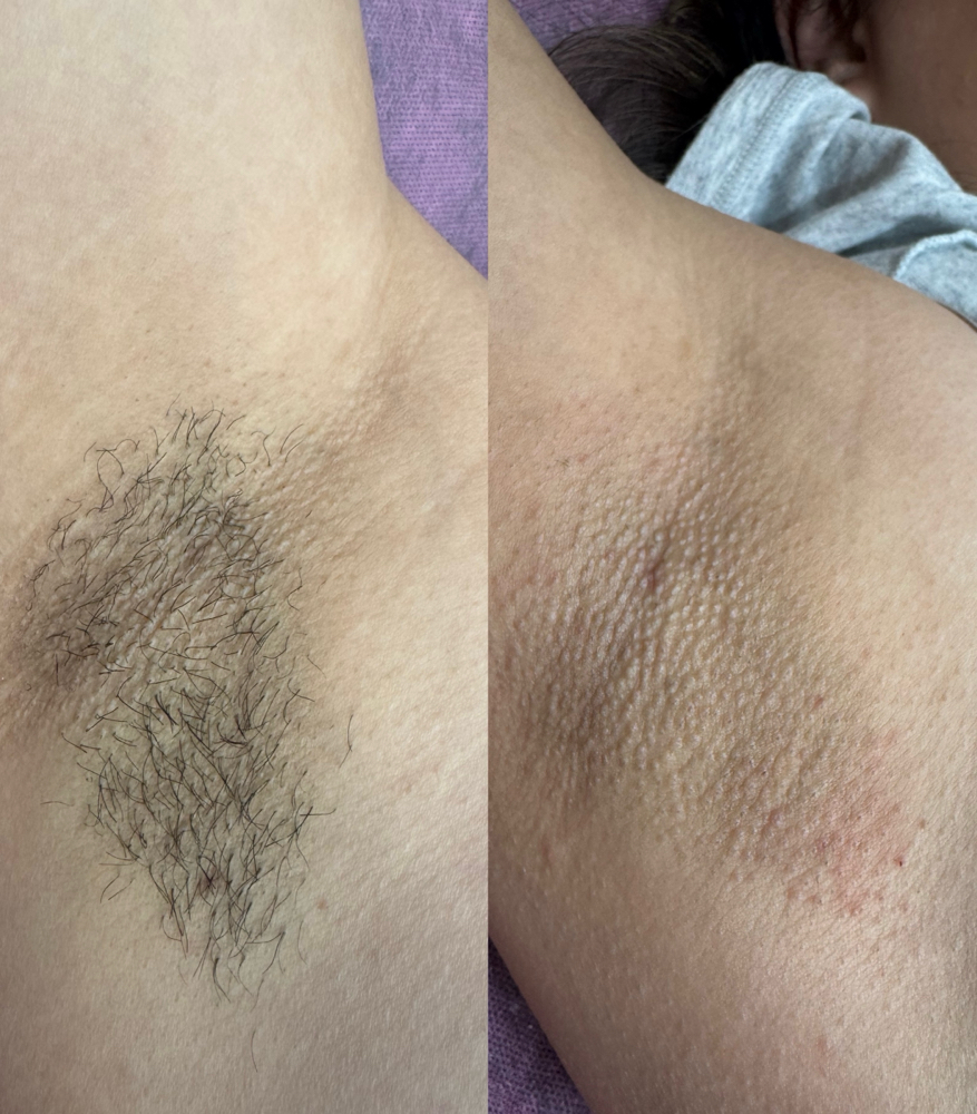 UnderArms