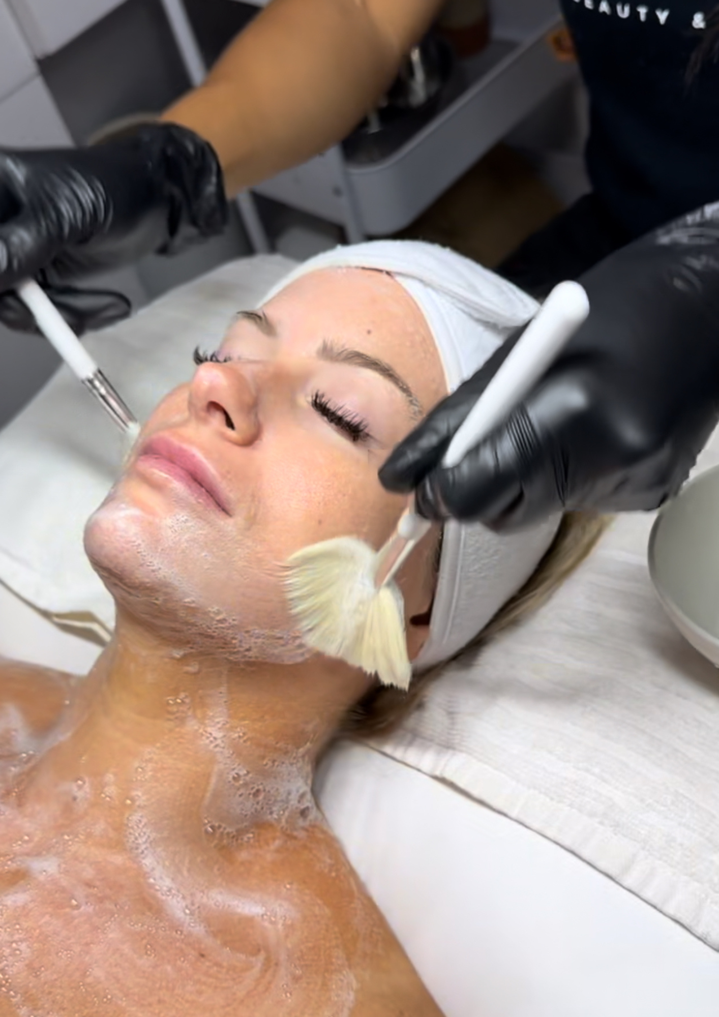 Glycolic Peel
