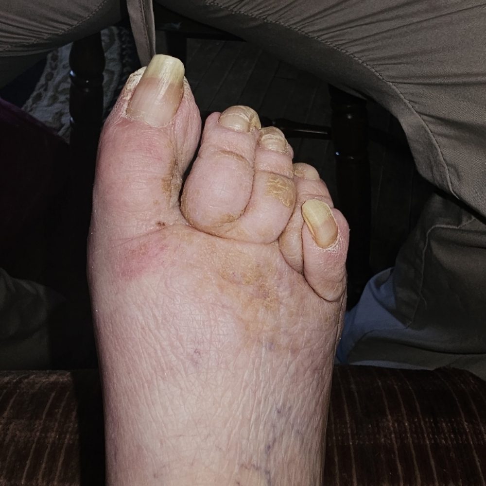 Therapeutic Waterless Pedicure at Mani D'Oro in Munster, IN