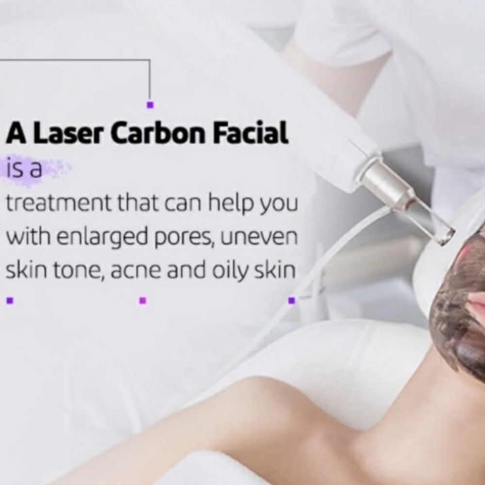 Carbon Peel Laser at Tina Perma Beauty Spa in Old Saybrook, CT