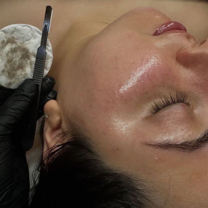 Dermaplane Glow Facial at Vally Mo & Co. in Bonita Springs, FL