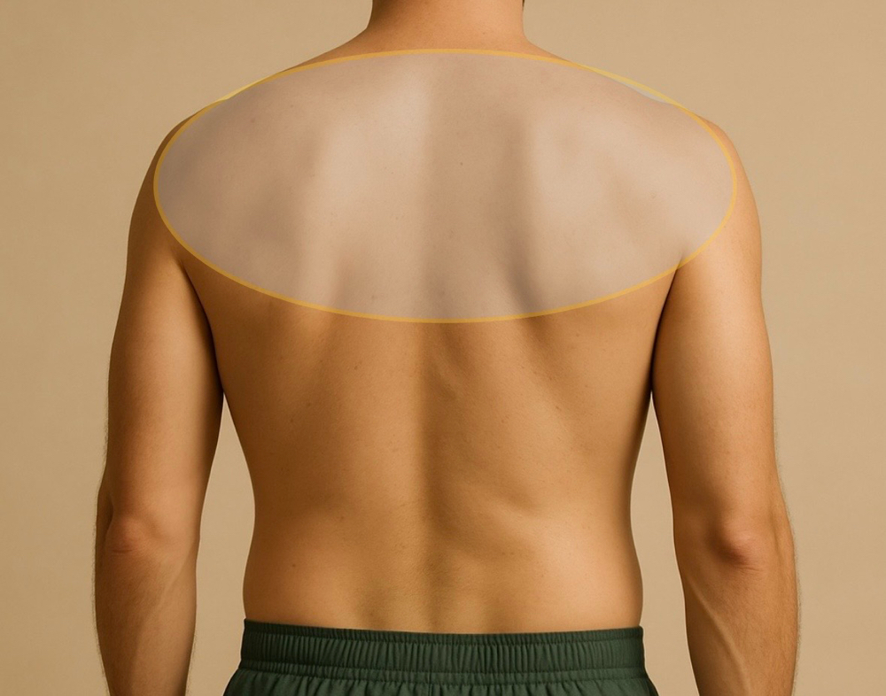 Upper Back