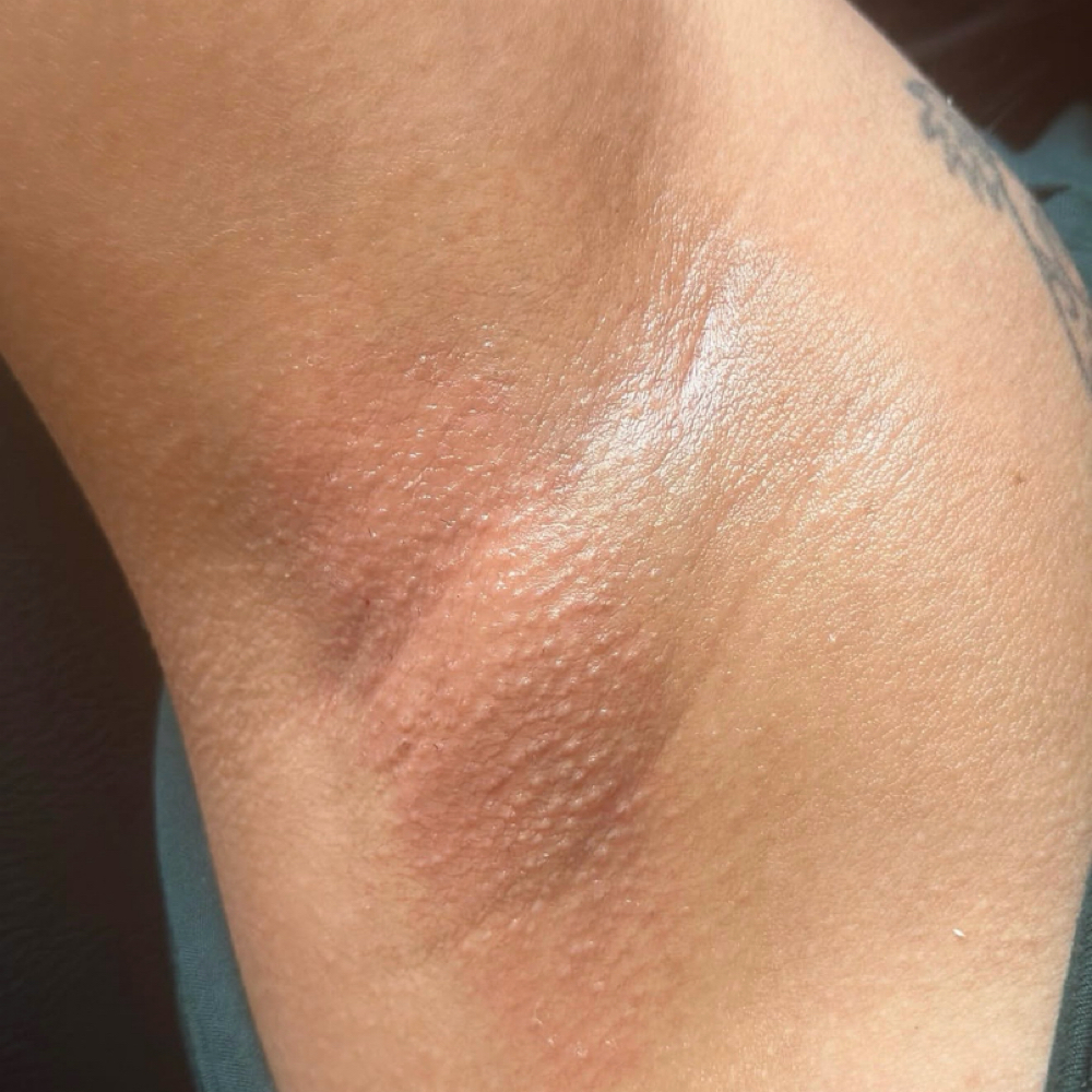 THE BARE UNDERARM $12 DEAL at The Bare Suite in Thornton, CO