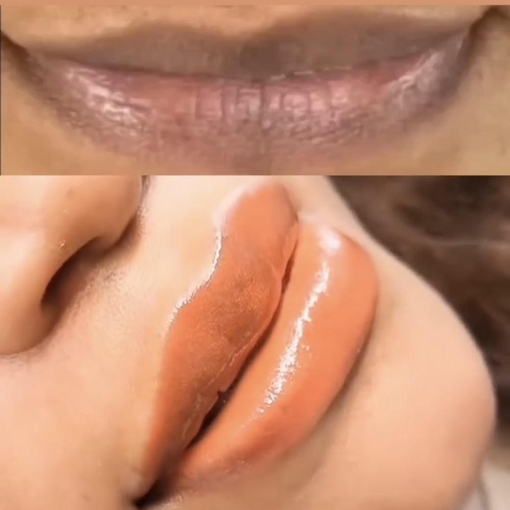 Lips Neutralization at CANELA STUDIO in CLIFTON PARK, NY