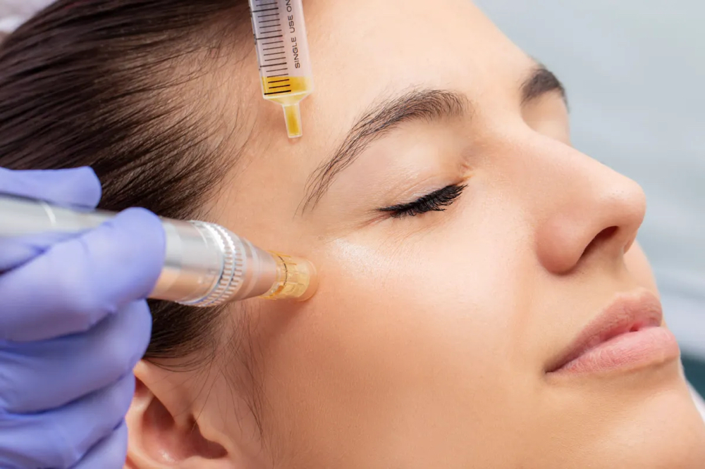 Microneedling Facial