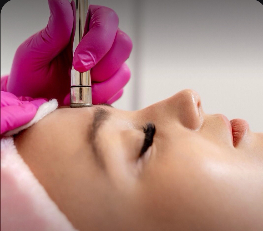 Microdermabrasion Deluxe treatment