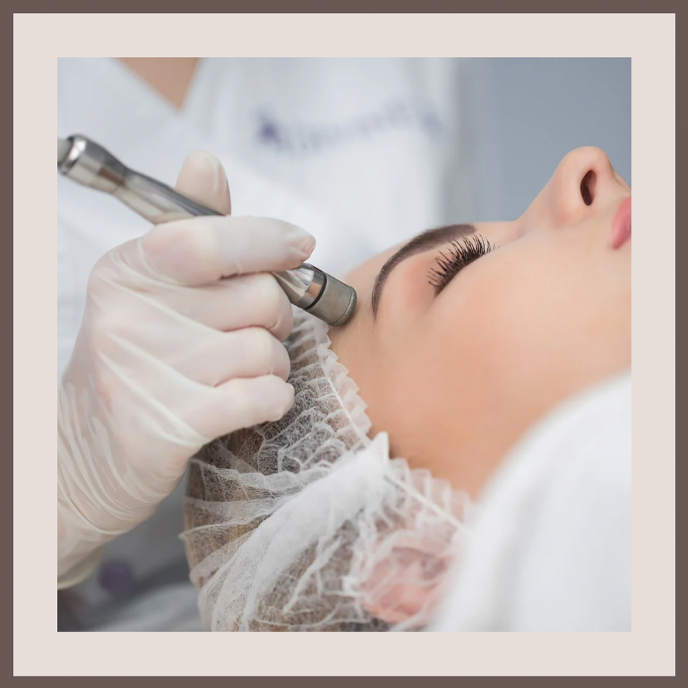 "Glow-Getter" Microderm Facial