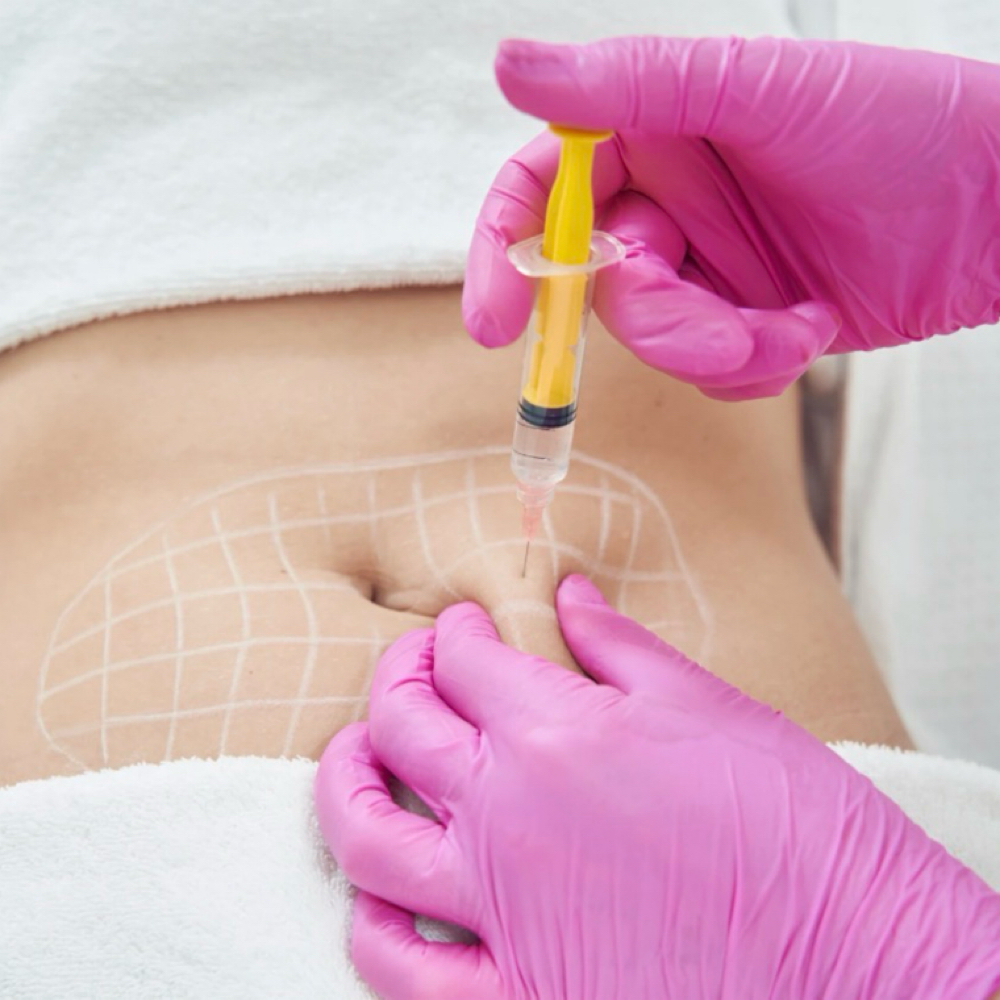 Lipodissolve at Birdie and Bloom Aesthetics & Wellness in Lubbock, TX