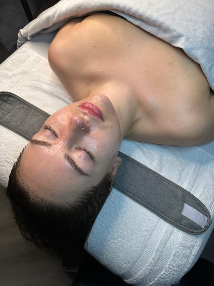 Microdermabrasion Facial