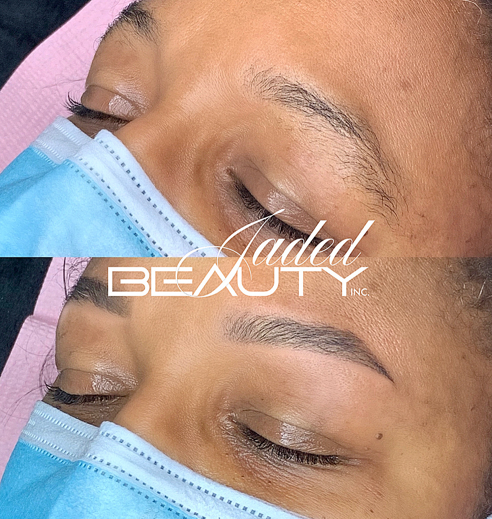 Brow Reconstruction