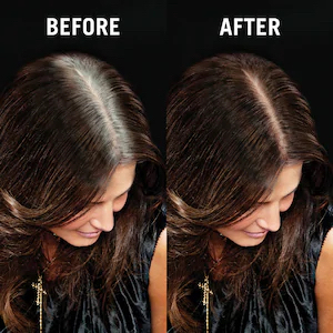 Root Retouch