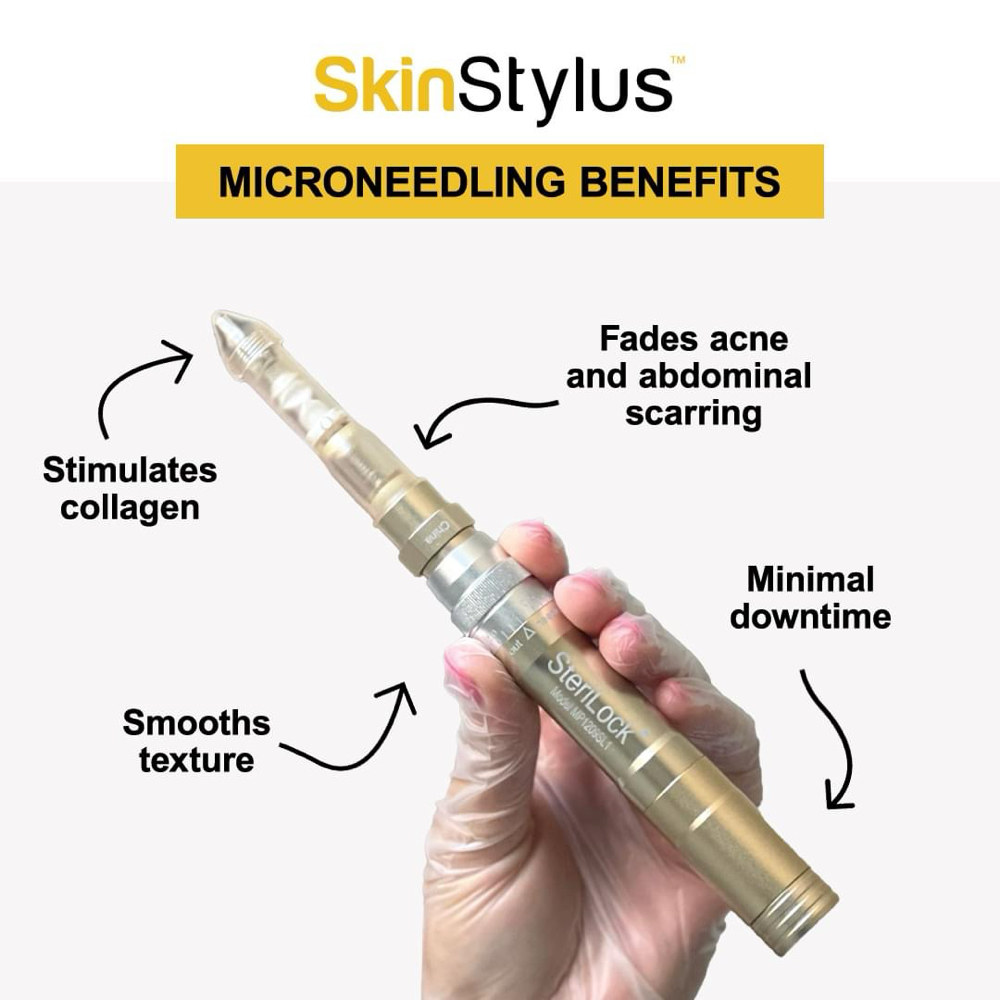 Microneedle SkinStylus