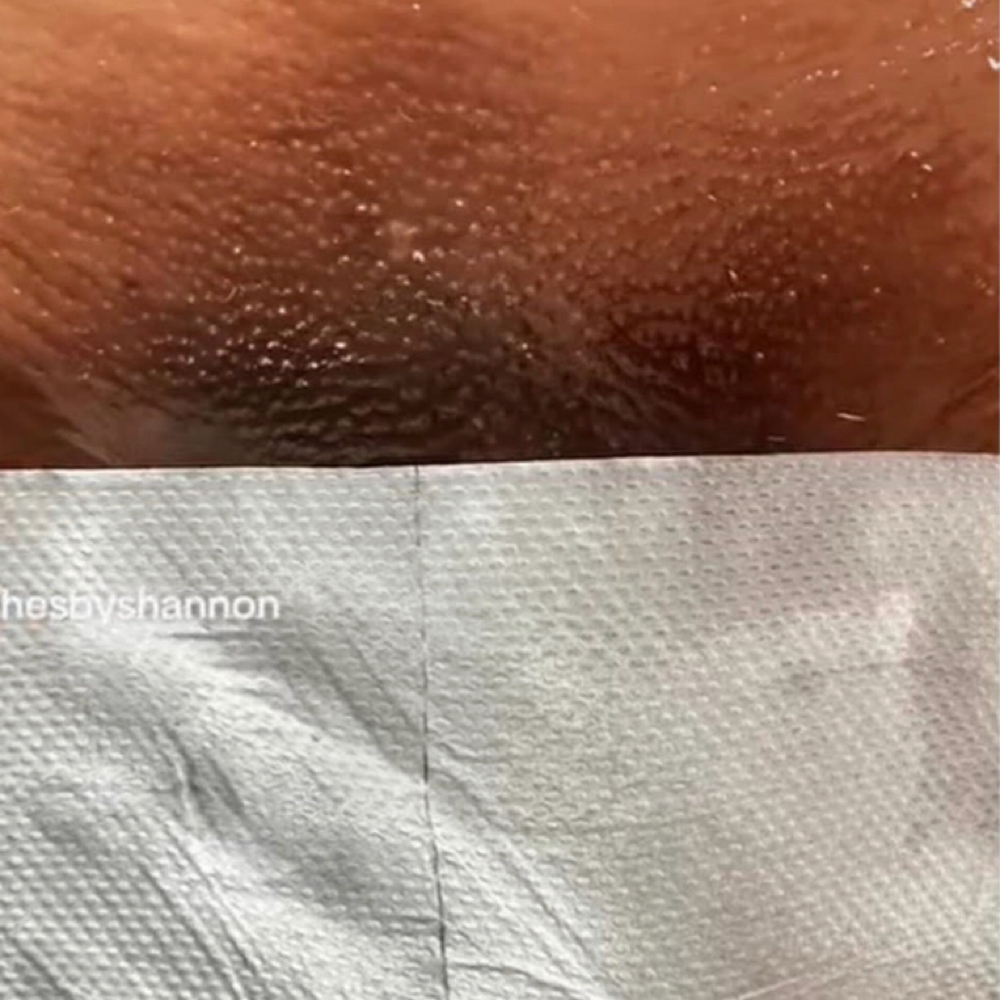 Full Brazilian (P) at Waxed Skyn in Cincinnati, OH