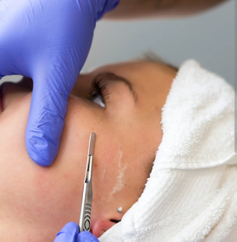 Dermaplaning Facial