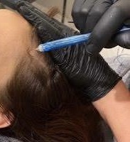 Scalp Facial
