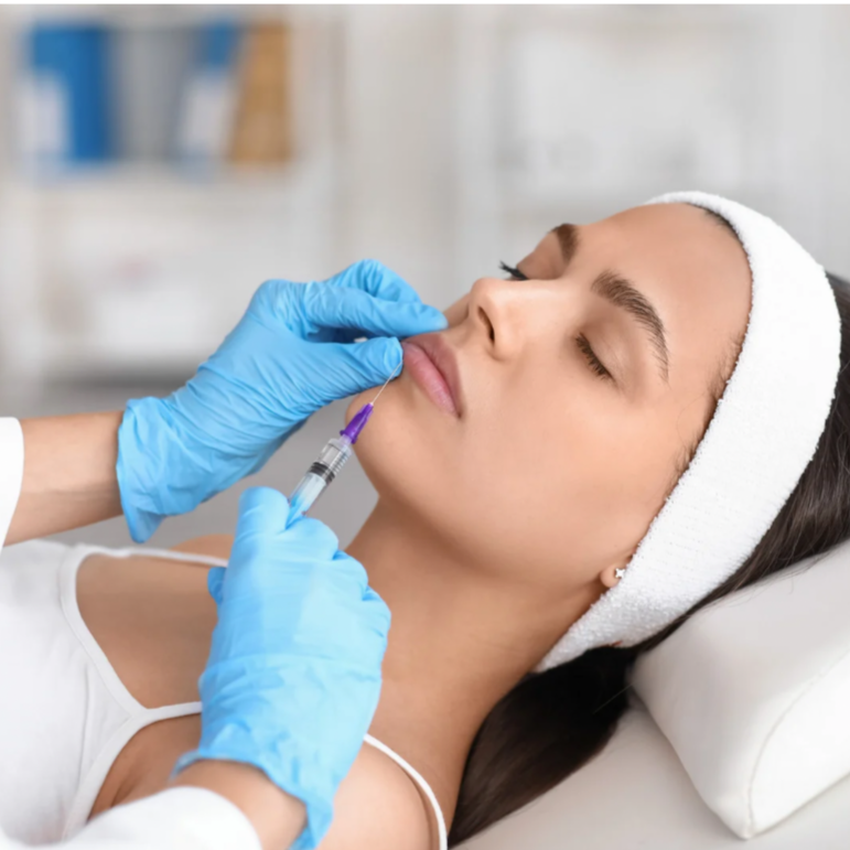 Lip Filler 0.5 ml at Luna Aesthetics in Alexandria, VA