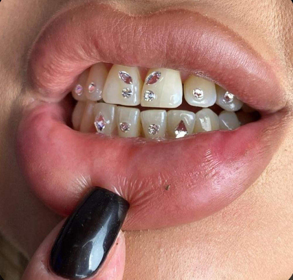 Freestyle 4+ Teeth