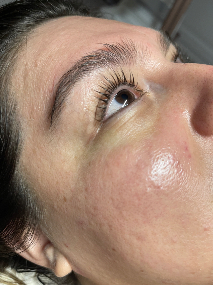 Eyelash Lift